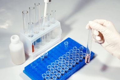 Lab technician in a hopital makes clinical analysis Lab technician scientist performs medical clinic chemical analysis and diagnostics using test tube phial and pipette.